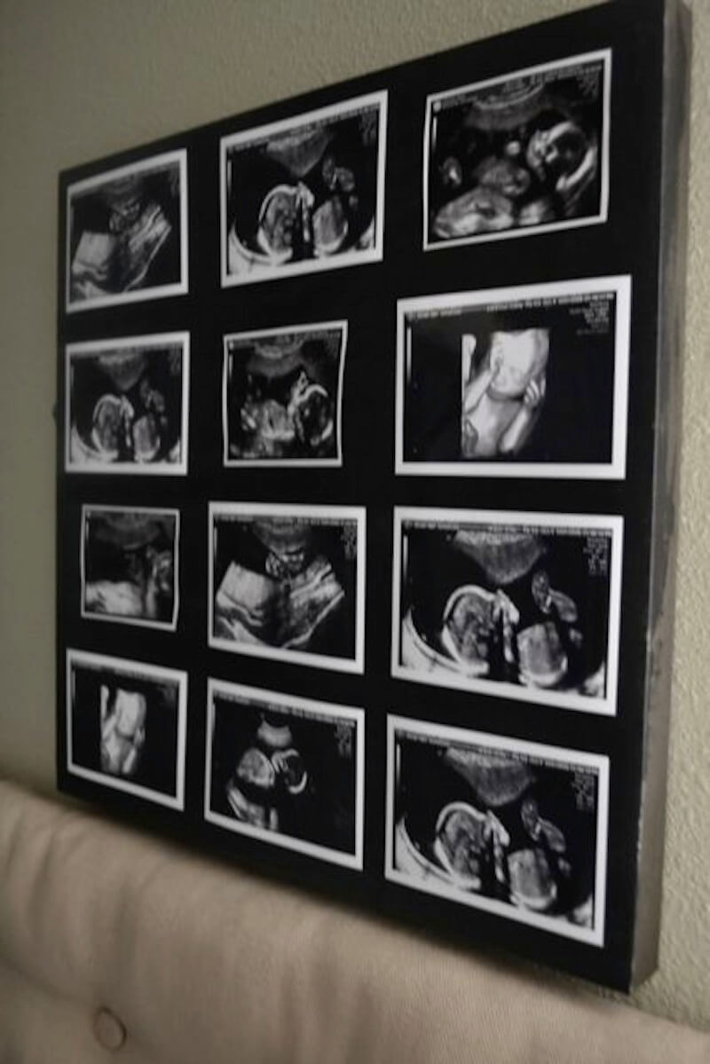 Ultrasound Wall Art Tells A Stylish Story